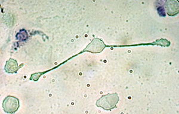 一个位于老鼠体内的巨噬细胞，正在延伸其假足以吞没两粒可能是病原体的颗粒