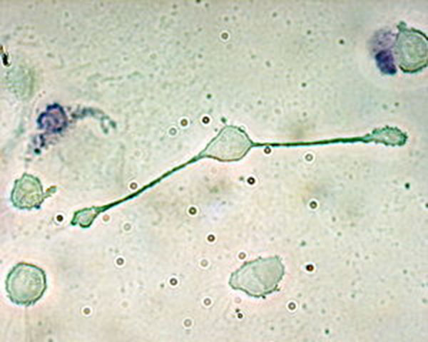一个位于老鼠体内的巨噬细胞，正在延伸其假足以吞没两粒可能是病原体的颗粒